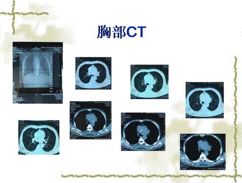 19岁的RAPPER潮水仙踪林 就让我们走进他的仙踪世界