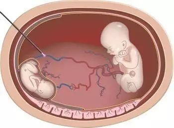 火 影 忍 者 小 南 +黄 本