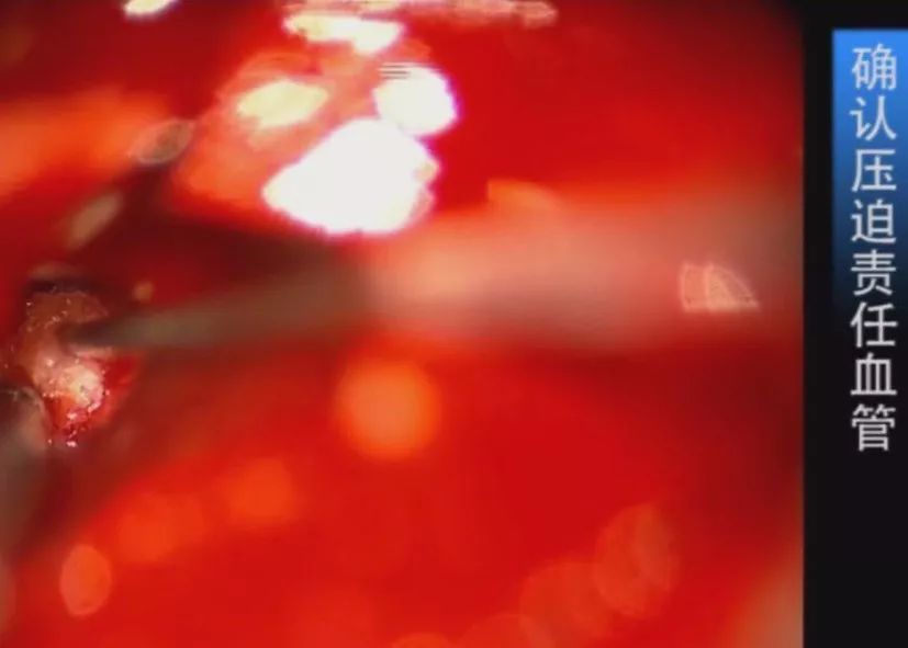 日本B站一卡二卡 使用日本B站一卡二卡时